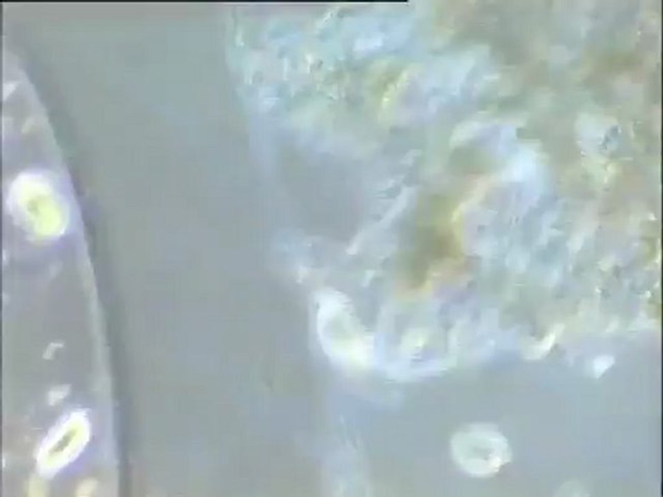 Observation d'une boue activée de Noisy-le-Grand : morphologie des flocs et biomasses