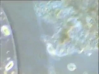 Observation d'une boue activée de Noisy-le-Grand : morphologie des flocs et biomasses