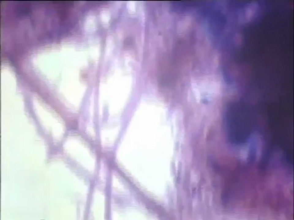 Observation d’une préparation de boue en coloration Gram à fort grossissement :  types morphologiques de filaments