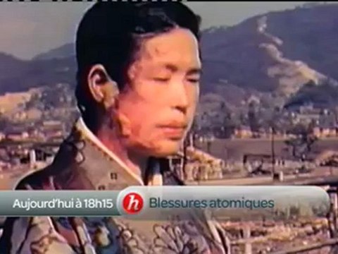 BA Les Blessures atomiques