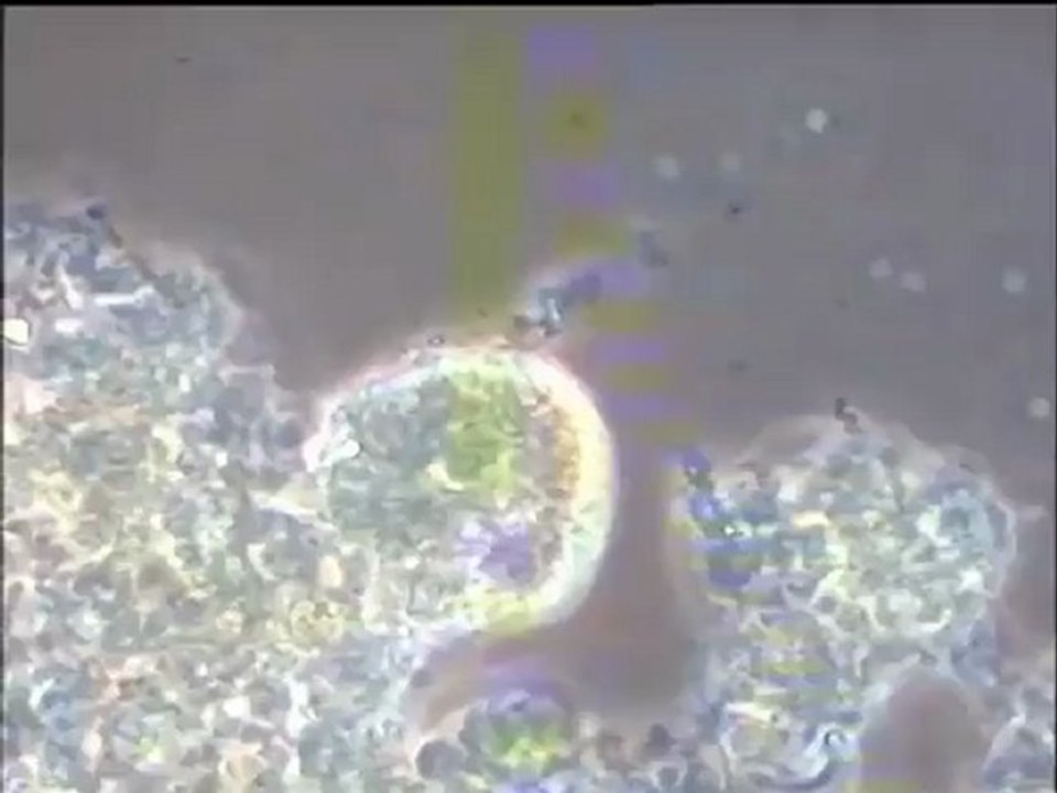 Examen de la boue de Noisy-le-Grand après traitement au chlorure ferrique (FeCl3) - suite