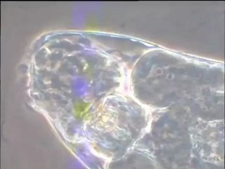 Microfaune d'une boue activée - détail de l'organisation de rotifères - scènes de prédation
