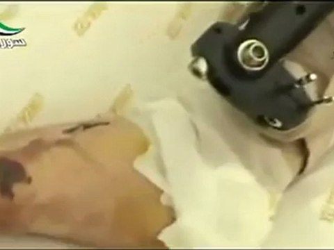 فري برس ‫الصيدلي الجريح عبدالقادر الغنطاوي ساعة الصفر 7 4 2012