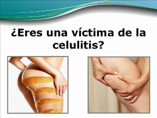 Elimina La Celulitis Rapido - Celulitis Tratamiento Natural