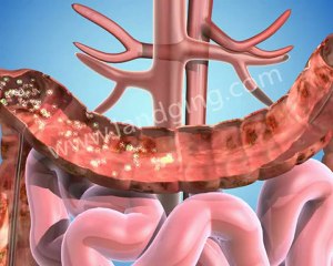 Digestive System Animation: Colon