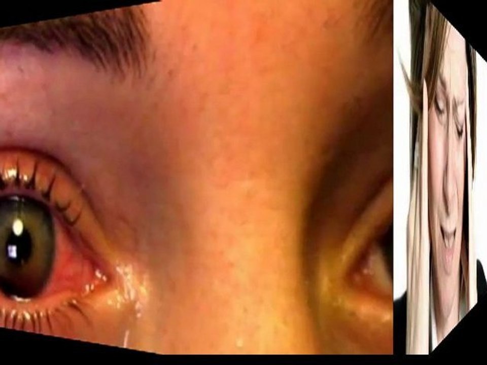 causes of blood pressure - treatment low blood pressure - natural treatment blood pressure