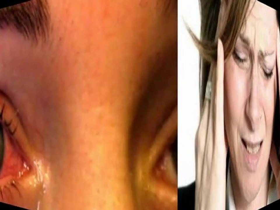 cause for high blood pressure - blood pressure treatment natural - natural cure blood pressure