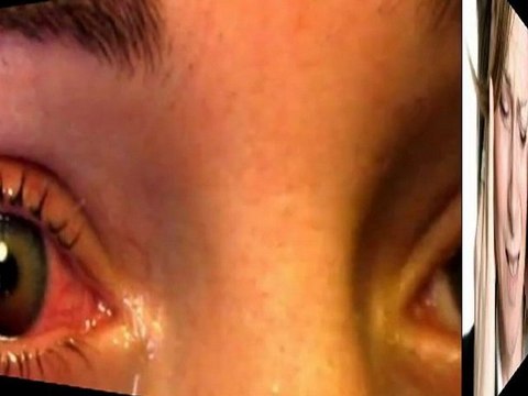 hypertension high blood pressure - what cause high blood pressure - high blood pressure