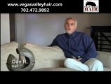 FUE Hair Restoration Treatment Las Vegas NV