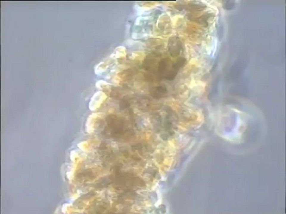 Examen détaillé d'un ver Naïs des biomasses d'un filtre à charbon actif de la CGE - étude de son alimentation d'après les résidus fécaux