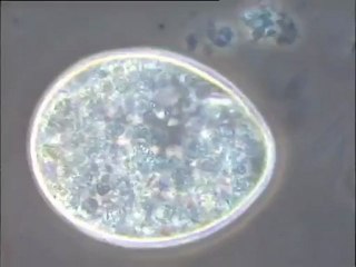 Examen d'un cilié Tétrahyménien au microscope fort grossissement sous différents éclairages
