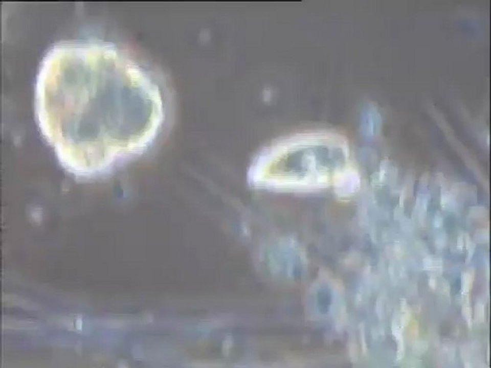 Examen de deux boues activées de provenance indéterminée au microscope : examen de la boue BR8