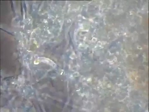 Examen de deux boues activées d’origine inconnue au microscope : examen de la boue B2