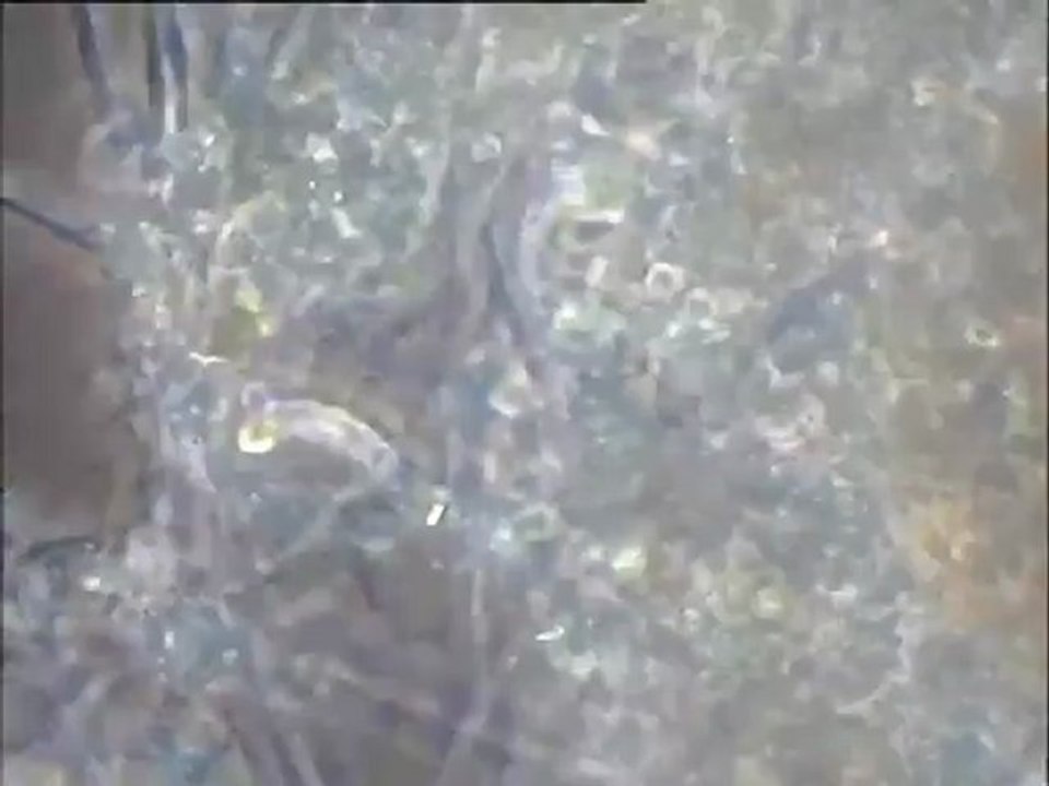 Examen de deux boues activées d’origine inconnue au microscope : examen de la boue B2