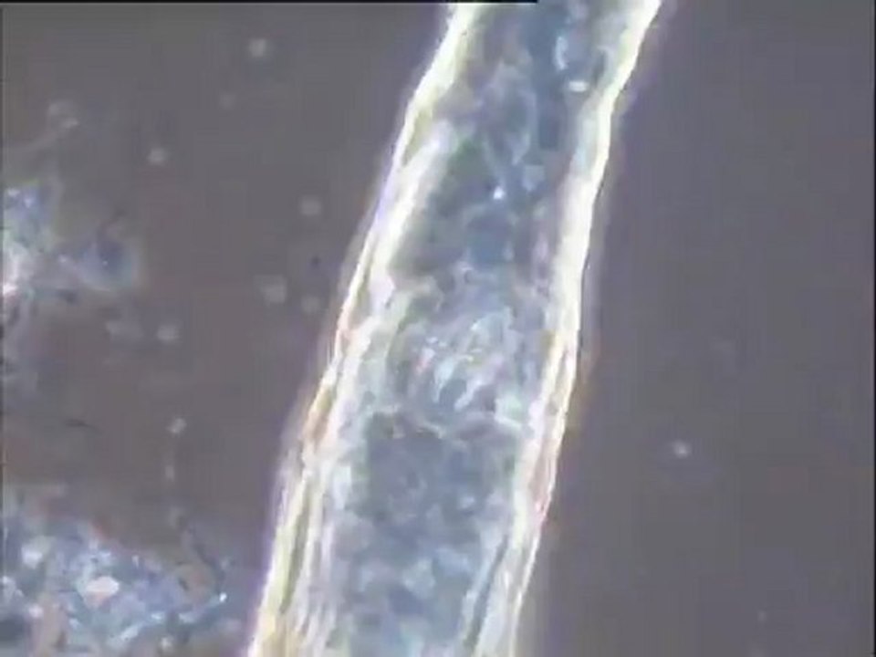 Examen des boues activées de la station de l'usine Motta : observation des mousses sur bassin