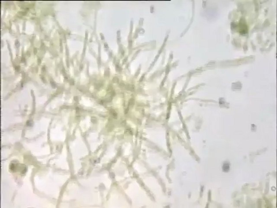 Examen de deux boues activées vues en coloration Neisser au microscope : usine de Motta et papeterie