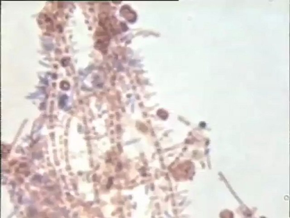 Observation au microscope de boues activées provenant de la station de l'usine de Motta après coloration Gram