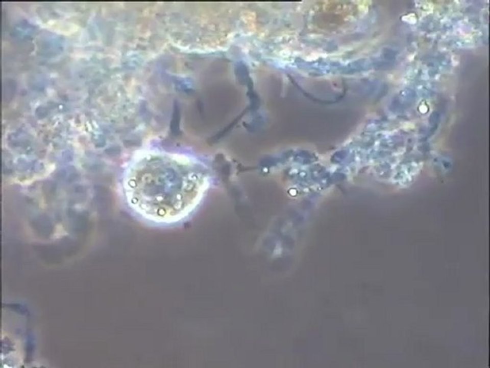 Observation d'une boue activée de la file est de la station de Versailles