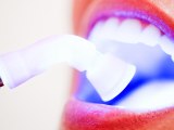 Myths about teeth whitening