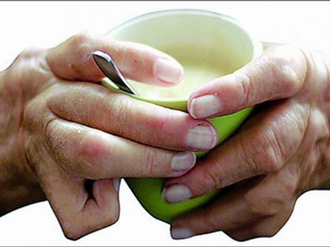 Tratamiento Para La Artritis Reumatoide