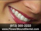 Lumineers Dentist Flower Mound TX-Save $100 per Lumineer