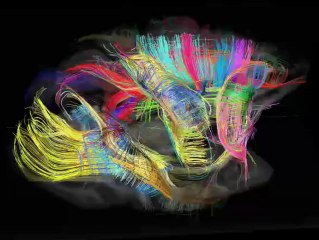 IRM du spectre de diffusion d'un cerveau de macaque rhesus