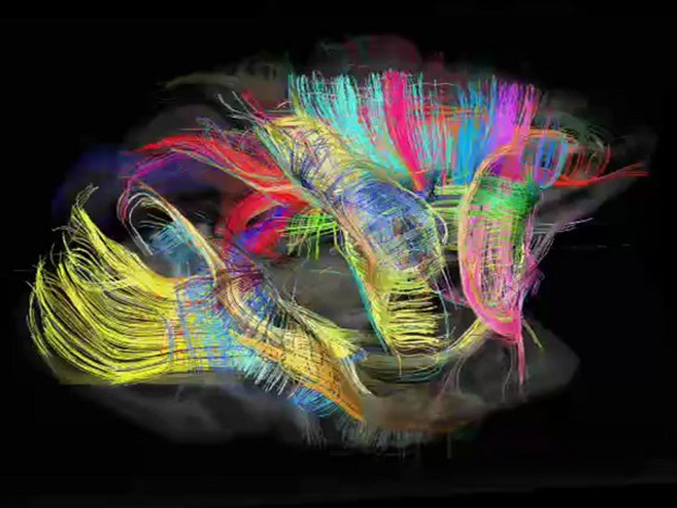 IRM du spectre de diffusion d'un cerveau de macaque rhesus