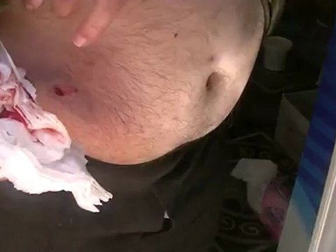 فري برس درعا اصابة احد المواطنين برصاص الامن بطريق السد 13 4 2012 Daraa