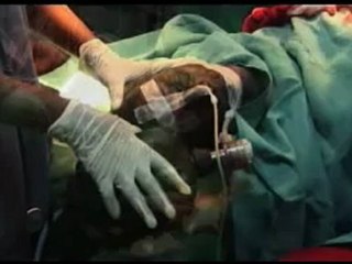 An African crisis worse than Darfur - 14 Nov 07