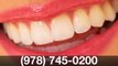 Lumineers Dentist Salem MA- Save $100 per Lumineer or Veneer