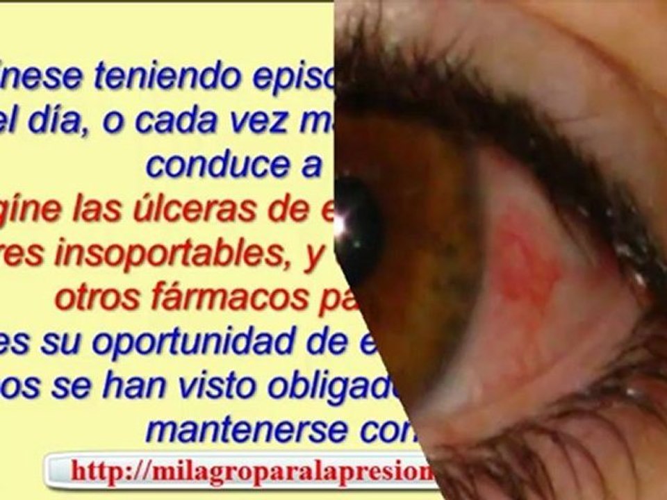 que es hipertension - que es hipertension arterial - tratamiento contra la hipertension