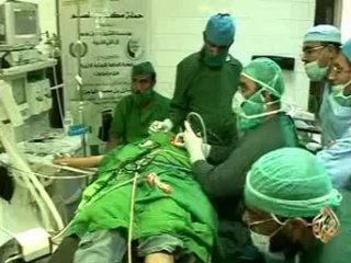 عمليات زراعة القوقعة الالكترونية لعلاج الصمم في اليمن