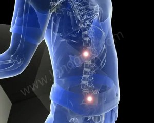 Accident Animation | Workers Compensation: Lifting Box