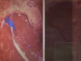 water damage woodland hills local 213-985-2805