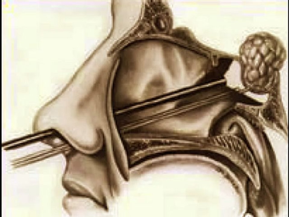 Microchip alieni e militari