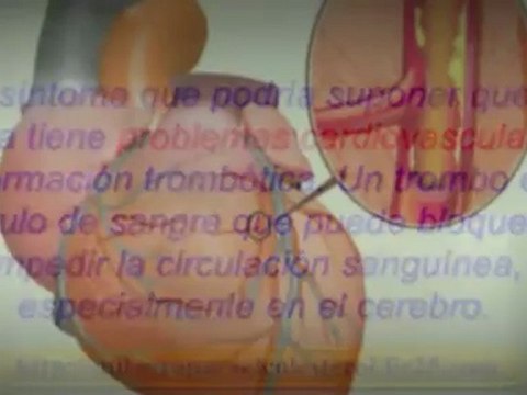 síntomas del colesterol alto - síntomas colesterol alto - que baja el colesterol