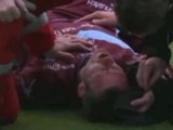 Un chirurgien choqué des graves blessures d'un footballeur au visage