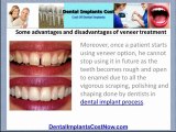 [How Much Do Porcelain Veneers Cost]