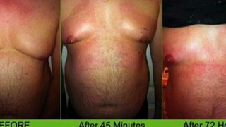 It Works Body Wraps Before and After