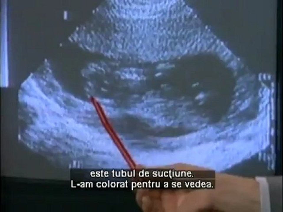 The Silent Scream _ Strigătul mut (Romanian subtitles) - video Dailymotion