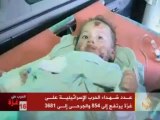 وصول عدد من الجرحى لمعبر رفح في المستشفيات المصرية
