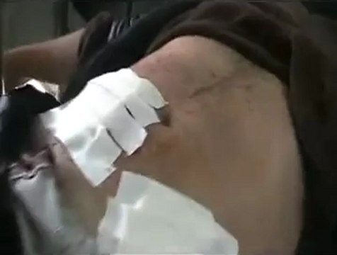 فري برس حمص الحولة إصابة شاب برصاص عصابات الأسد23 4 2012 Homs