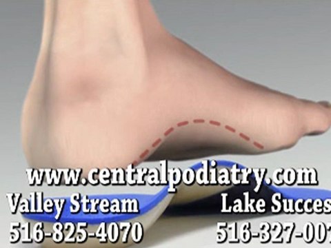 Custom Orthotics - Podiatrist in Valley Stream and Lake Success, NY