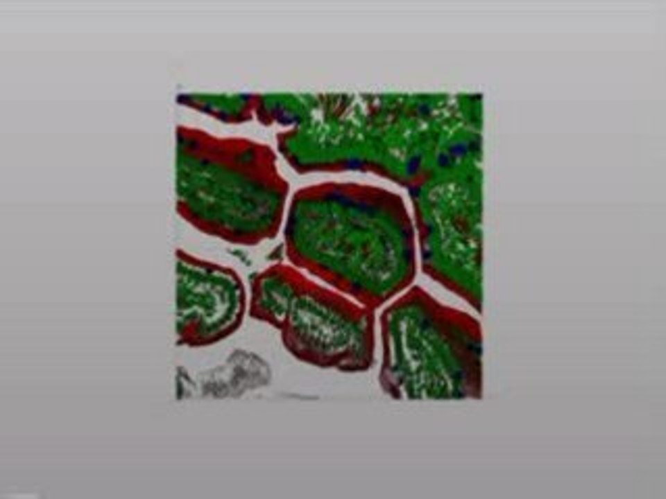 3D reconstruction1