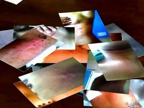 Brazil Sex Worker Plans to Sue U.S. Embassy for Running her Over