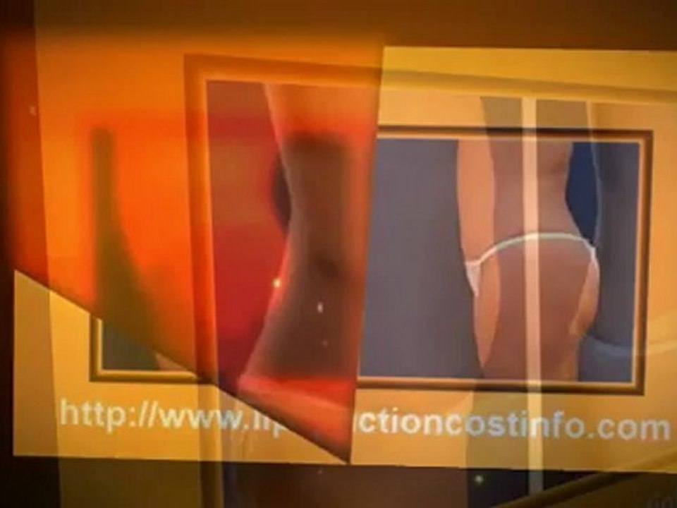 Liposuction Before and After