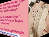 what are symptoms of ovarian cysts - symptoms for ovarian cysts - signs ovarian cysts