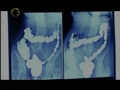 Saber Vivir: ¿cuáles exámenes deben hacerse las mujeres?