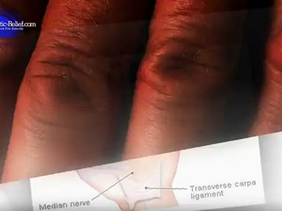 Numbing Of Fingertips - Numbing Of The Fingertips