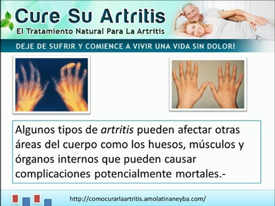 Que es la Artritis - síntomas y causas